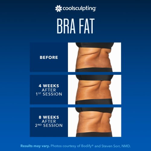 BDA-Bra-Fat_Frame-01-q9y4nf9lv22m2ry54wjusf0z0y2fmzaxevw01a4z2g