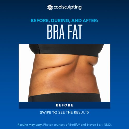 BDA-Bra-Fat_Frame-02-q9y4ni34fk6h1lu1ofrqhwbct3oja2m4f9ugh40sjs