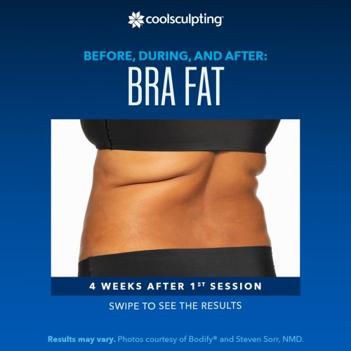 BDA-Bra-Fat_Frame-03-q9y4njyst891otrbdgkzmvu9zvf9pgtl3j5ffny07c
