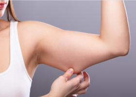 How-To-Lose-Arm-Fat-Without-Exercise